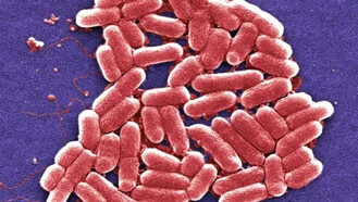 Кишечная палочка (escherichia coli) симптомы, в моче, лечение