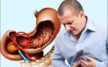 Симптомы и признаки внутреннего кровотечения
